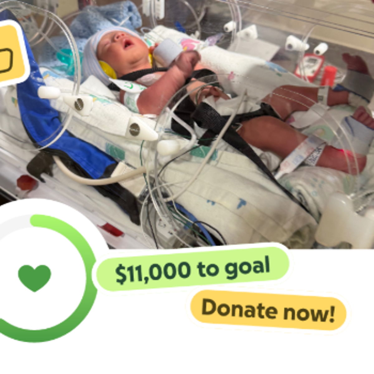 Support Baby Leo's NICU Journey